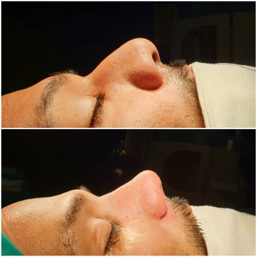 fotos antes y después de nuestros pacientes 11
